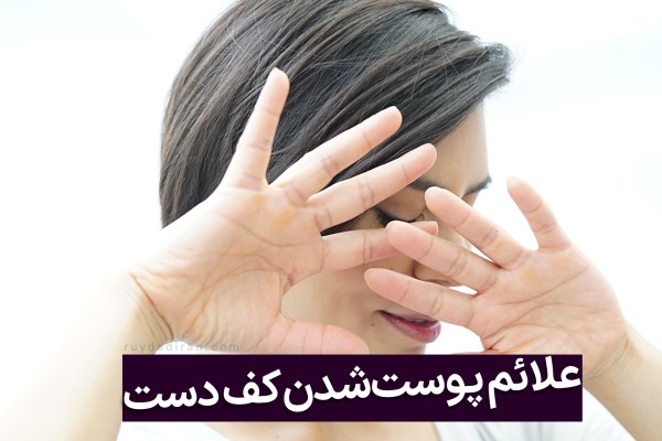 نیمرخ دختری با لبخند کف دستان خود را به طرف صورت برده و به دوربین نشان داده است