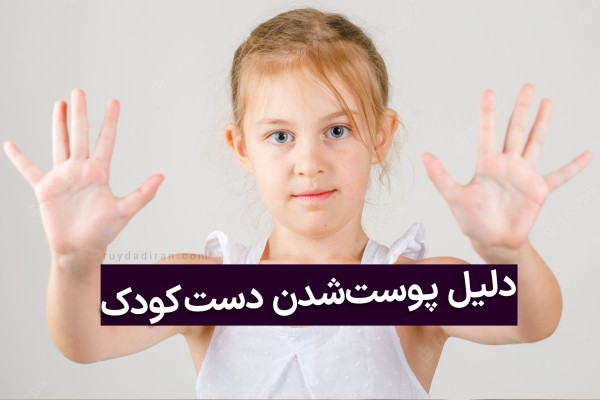 کودک با موی بور کف دست های خود را رو به دوربین گرفته است