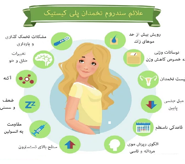 علائم سندرم تخمدان پلی کیستیک
