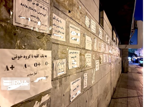 آگهی خرید و فروش کلیه