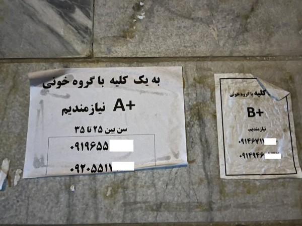 آگهی خرید و فروش کلیه