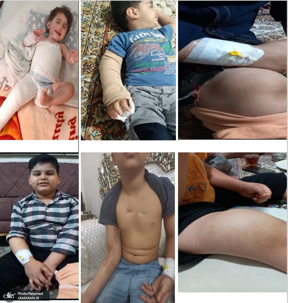 بیماران هموفیلی