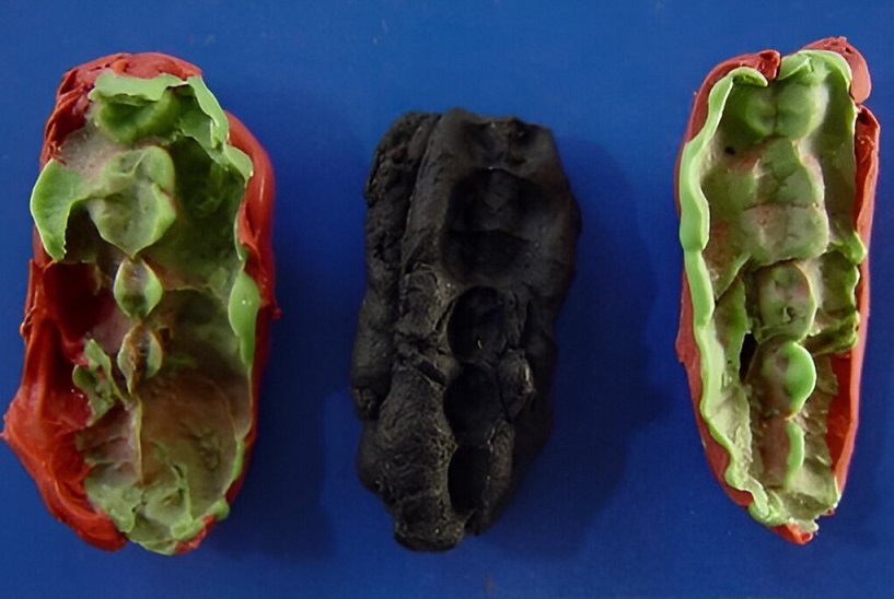 این آدامس‌های 10 هزارساله چه حقایقی را فاش کرده‌اند؟